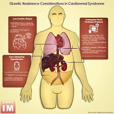 Image result for Diuretic