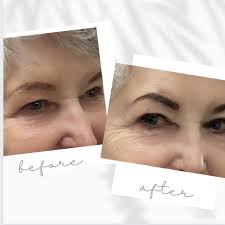 BEST of Surprise Wolf Cut