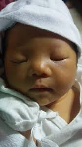 Good day mag ask lang sana if mukha po ba syang may down syndrome ? . If  ever saan po may malapit sa taguig na may 2d echo & karyotyping . Public