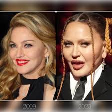 Que le paso a Madonna? Siempre polémica y probablemente con un aspecto  deseado por ella, ha impresionado a muchos durante los premios Grammy.  Claramente hay un exceso de rellenos en su cara :