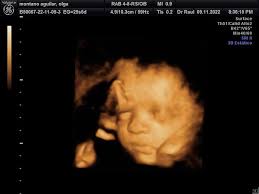 Dr. Raúl Roman Campos (@dr_raul_roman_campos) • Instagram photos and videos