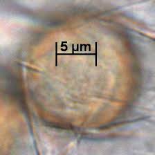 Image result for Micrargeria filiformis