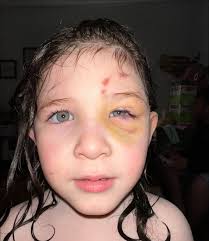 Protect your babies from strangers approaching