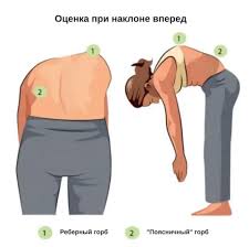 Тест Адамса