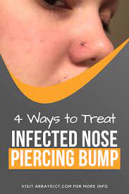 4 Things To Treat Infected Nose Piercing Bump Without Closing It Piercing Bump Nose Piercing Stud Nose Piercing Care