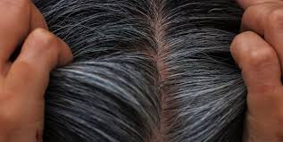 Dolayısıyla beyaz saçlar ne renk boyanmalı diye düşünürken beyaz kapatmanın ustalık gerektiren bir iş olduğu gerçeğini gözden kaçırıp, saçınızı kendiniz kısacası beyazları kapatmak için boya seçiminde herkesin kendi orijinal saç rengine yakın renkleri tercih etmesi ve eğer boya yapma konusunda. Saclardaki Beyazliklar Nasil Kapatilir Cilt Guzellik