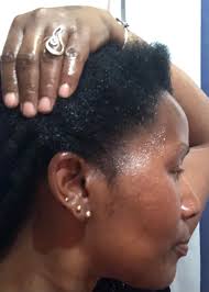 Clove Hair Growth Oil