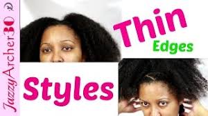 If you hair loss is recent, we can often stimulate regrowth, but with recurrent and repeat damage through aggressive styling, hair follicles can be permanently damaged. How To Hairstyles For Thinning Edges Afro Youtube