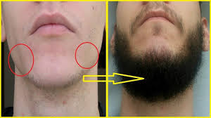 You can always try these natural ways to grow facial hair fast. How Mustache Grow Faster