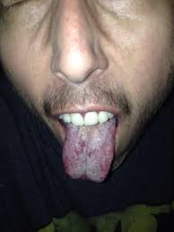 Fundraiser by Biz Franzen : Andy's Fight Against Colon Cancer!