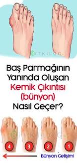 Pin By Sukran Kocabiyik On Islami Moda Health Tips How To Treat Bunions Health And Beauty