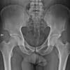 Related online courses on physioplus. 1