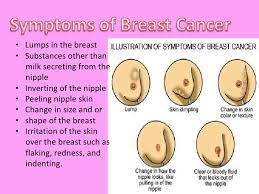 I had neither soreness nor a lump. Breast Cancer