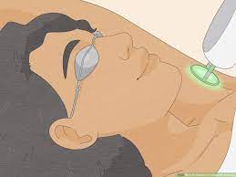 Feb 22, 2021 · to remove the unwanted hairs, the follicles must be present in your skin whenever you are using the light. 3 Ways To Prepare For Laser Hair Removal Wikihow