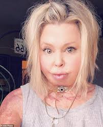 Indiana woman, 36, was set alight while tending to her backyard firepit