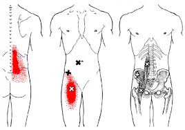Anatomy is the study of human anatomical structure. Massage Therapy For Low Back Pain Physio Logic In Downtown Brooklyn
