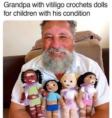 This makes me so happy. This is the condition and I shared with you guys…