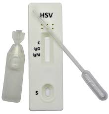 Image result for Herpes Simplex Virus Testing