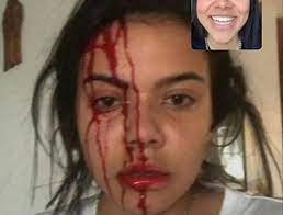 Jak nazywa się pies lexy? Polska Youtuberka Dostala Telefonem W Twarz Udostepnila Drastyczne Zdjecie