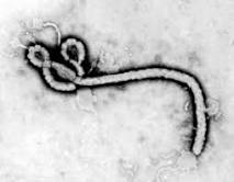 Ebola Virus History: First Picture Taken at CDC in 1976 | Time