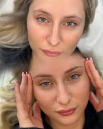 Headache Center Ohio