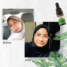 What attracted me in the first place was the packaging, it totally just screams natural among all the other brands sitting along side it. Garden Of Eden Rosa T Acne Serum 5ml Alpro Pharmacy