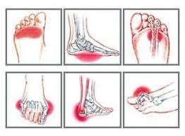Your doctor finds out the right foot pain side of your foot diagram for giving you proper treatments. Foot Pain Diagram Why Does My Foot Hurt