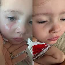 As moms, we know how every little scrape, cut, or scratch can feel like a  big deal to our little ones. 💔 But with Mustela Cicastela, I have peace of  mind knowing