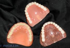 Your gums can change shape soon after teeth extractions. Immediate Denture Home Care Julie M Gillis Dds
