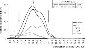 Image result for Nerve Conduction Velocity