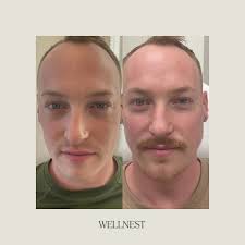 Wellnest Aesthetic Lounge