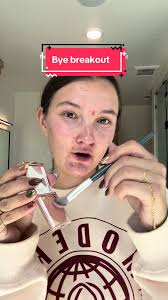 How to Cover Pitted Skin with Makeup