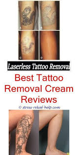 Custom Tattoo Big Tattoo Removal Before And After How To Remove A Tattoo With Salt Tattoo Remov Tattoo Removal Cream Laser Tattoo Removal Tattoo Removal Cost
