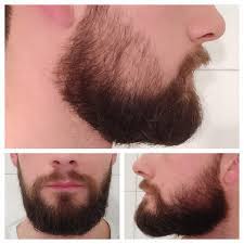 Left Cheek Top Picture Is A Lot Weaker Than The Rest Of My Beard After Letting It Grow 3 Months Should I Continue Or Beard Styles For Men Beard Beard Styles