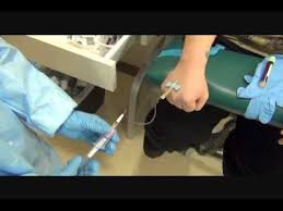 Butterfly Hand Phlebotomy Outside Vein Activation Wmv Medical Assistant Skills Phlebotomy Phlebotomy Study