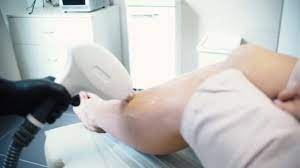 Wiki researchers have been writing reviews of the latest hair removal lasers since 2015. Procedure Of Laser Hair Removal On A Diode Laser Stock Hair Removal On The Legs Using A Diode Laser Hair Removal On The Legs Device Stock Video Footage By C Mediawhalestock 197809200