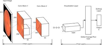 Deep Learning In Ophthalmology A Review Sciencedirect