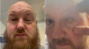 More than 1,000 people waiting for transplant in North East and Yorkshire  as numbers hit record high