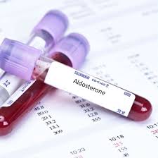ALDOSTERONE:VERIFICA LA QUANTITA’ DI ACQUA E SALI MINERALI ALL’INTERNO DEL SANGUE