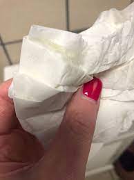 This is because, during ovulation, the body produces up to 30 times more discharge than during normal times. Ewcm After Ovulation Pic Attached Trying To Conceive Forums What To Expect