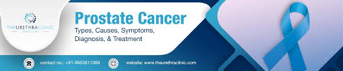 Eau guidelines on prostate cancer. Prostate Cancer Types Causes Symptoms Diagnosis Treatment