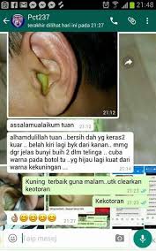 3 jenis obat herbal untuk mengobati penyakit snot pada ayam. Pencuci Telinga Ajaib Startseite Facebook