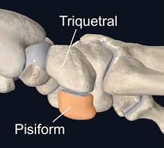 Image result for Pisiform Bone