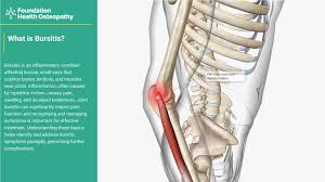 Image result for Bursitis