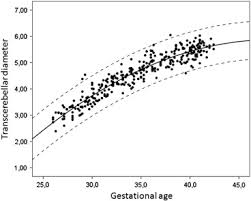 nomograms of cerebellar vermis height and transverse