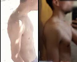 I Could Finally Fix My Posture And Forward Neck After Years It Was Very Simple Bodyweightfitness