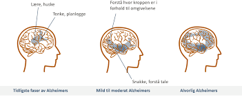 Begge sygdomme forringer kognitive funktioner. Https Www Menon No Wp Content Uploads 2020 63 Alzheimers Og Annen Demenssykdom Utredning Og Behandling Pdf