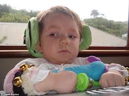 New Zealand boy left disabled after doctors failed to diagnose his  meningitis