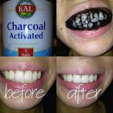 To know how to whiten your teeth naturally you will need to try many of the aforementioned recipes. Pin On Live Naturally