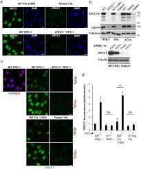 We did not find results for: Xrcc1 Mutation Is Associated With Parp1 Hyperactivation And Cerebellar Ataxia Abstract Europe Pmc